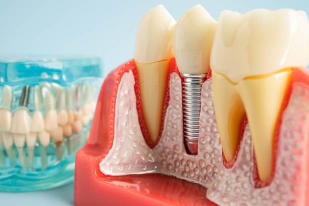 Best Dental Inlays and Onlays  in South River, NJ